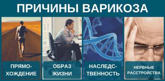 причини варикозу